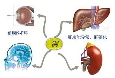 人體小蝌蚪视频官网數據能夠準檢測出但身體中微量元素銅超標會引起疾病發生 人體小蝌蚪视频官网數據能夠準檢測出但身體中微量元素銅超標會引起疾病發生